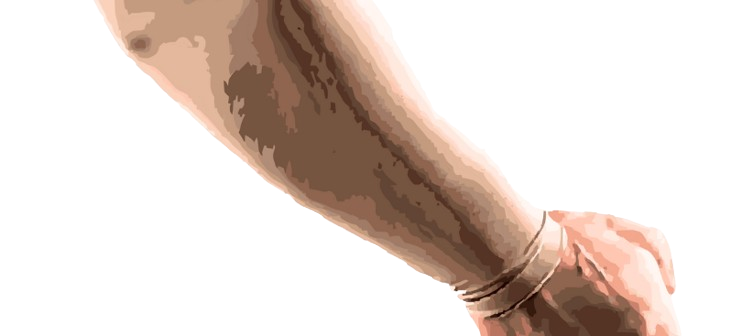 compression arm sleeves